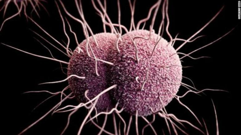 This image has an empty alt attribute; its file name is gonorrhea-bacteria.jpg